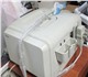 Скачать фотографию Другая техника УЗИ-Сканер SonoFine EUS B2* 4012772 в Санкт-Петербурге Foto в Электроника и техника Другая техника Ультразвуковой портативный сканер Sonofine в Санкт-Петербурге 65 000